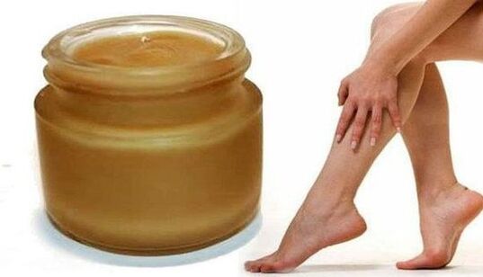 Pommade avec des varices