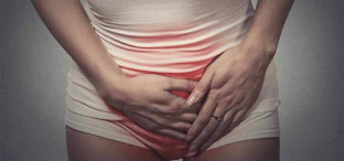 Douleur dans le bas de l'abdomen chez une femme présentant des varices du petit bassin