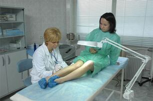 Thérapie au laser pour les varices dans les jambes